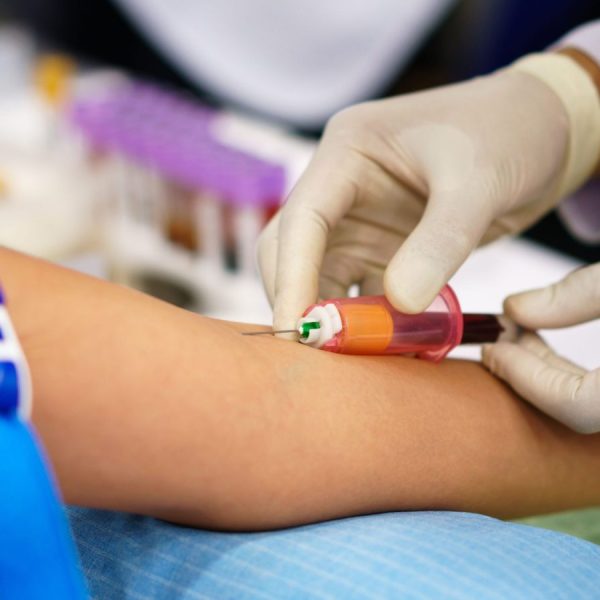 اعزام پرستار و آزمایش در منزل تهران